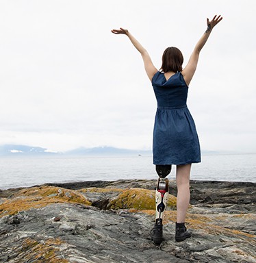 woman with robotic leg at ocean